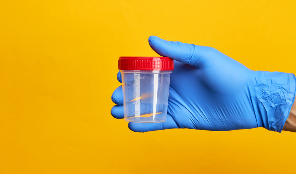 WILL VAPING CBD SHOW UP IN A DRUG TEST? Just CBD Store WILL VAPING CBD SHOW UP IN A DRUG TEST? Just CBD Store